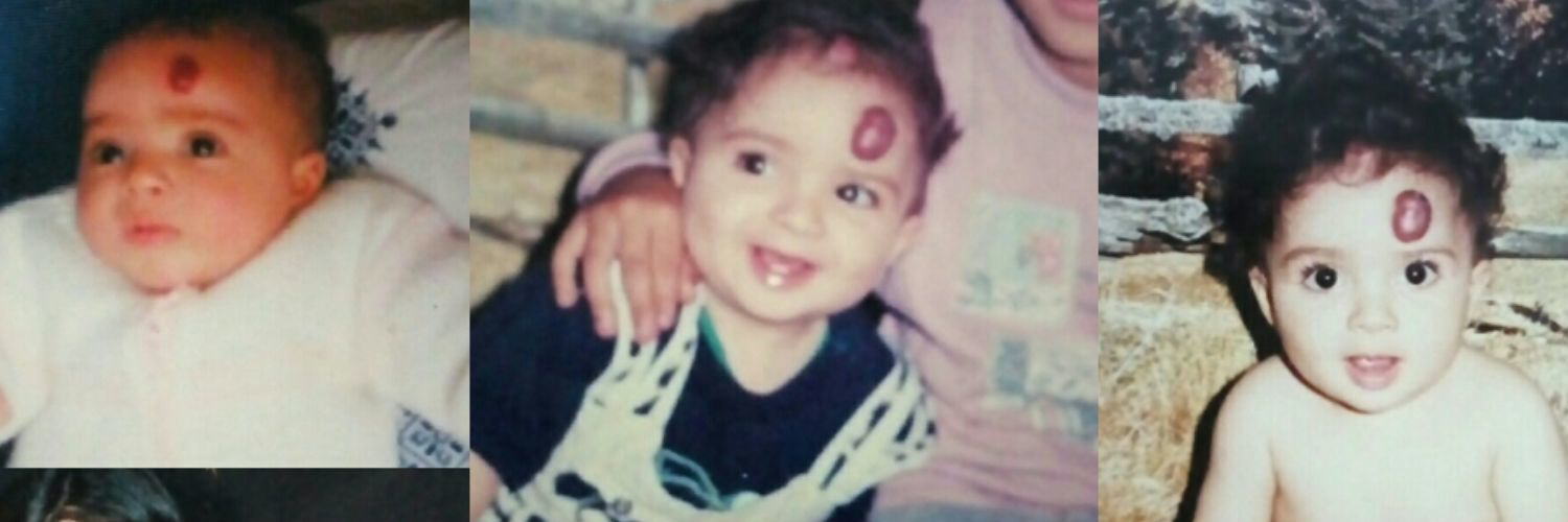 Self-discovery with Hemangioma