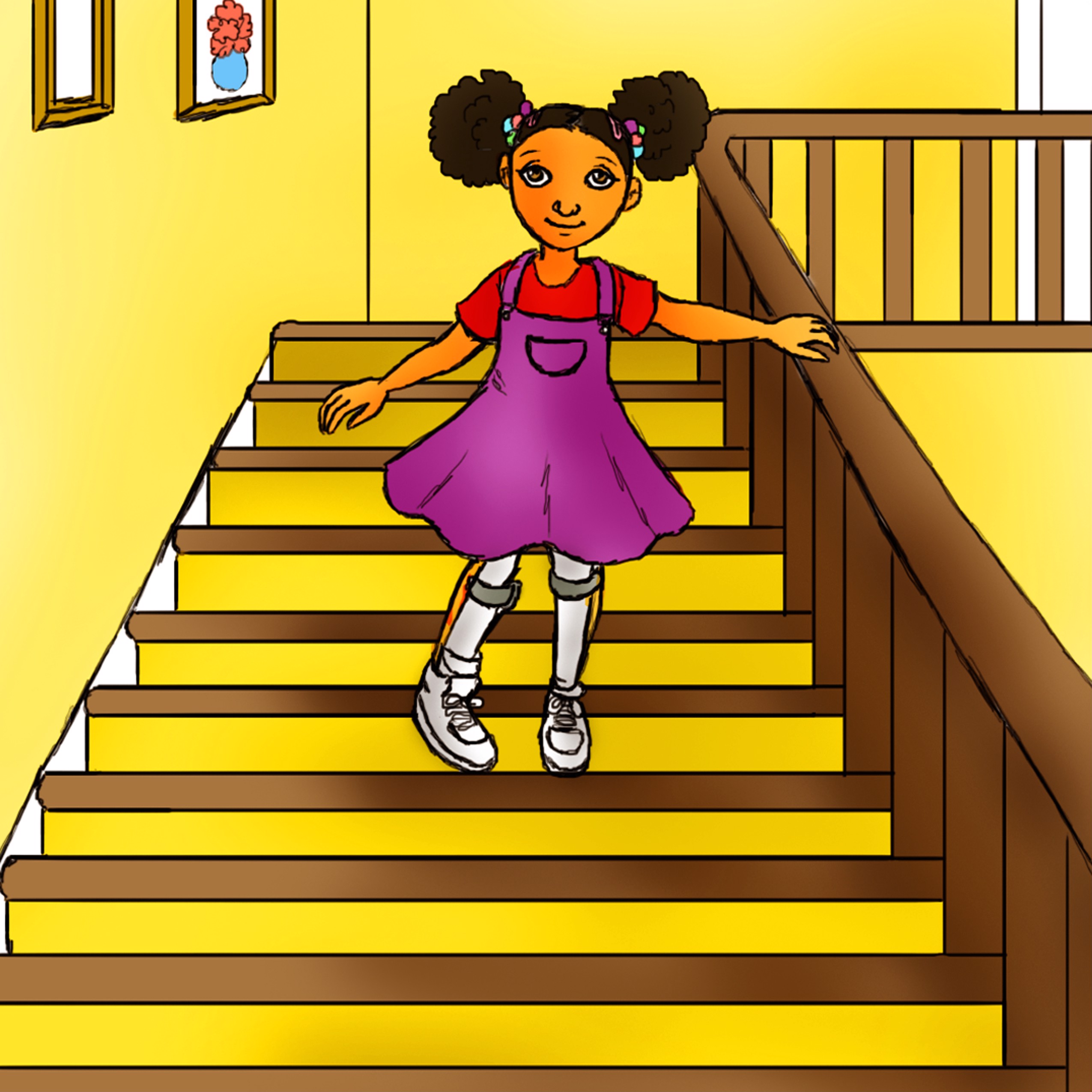 Living with Beals syndrome