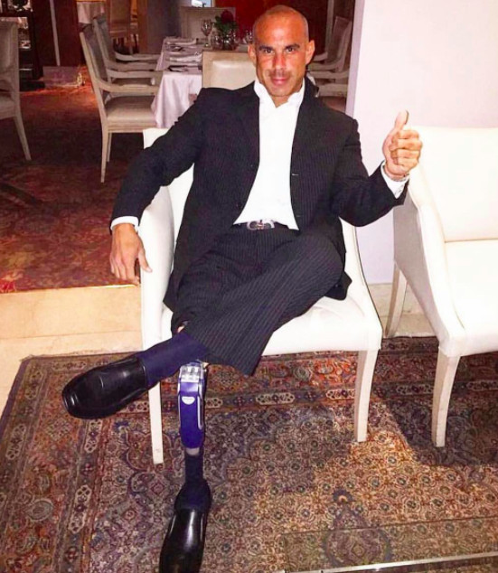 Overcoming Limb Loss