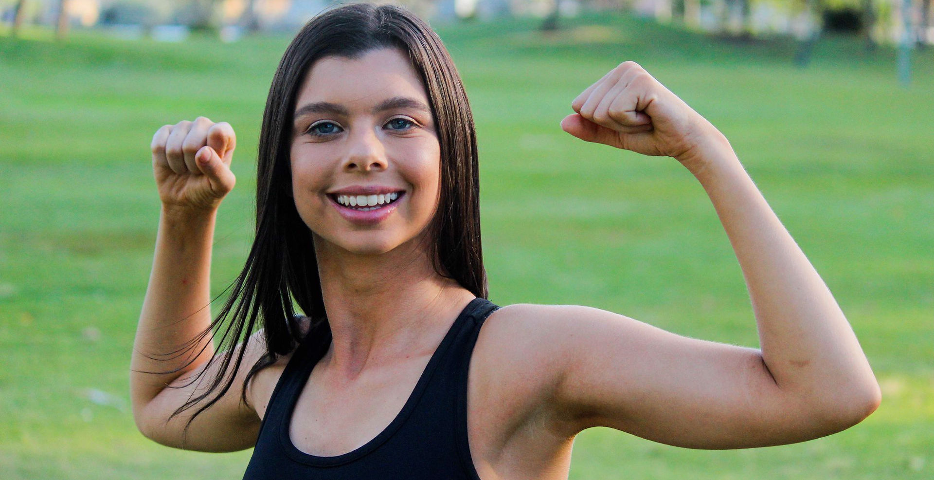 Worlds First Fitness Model with Williams Syndrome?
