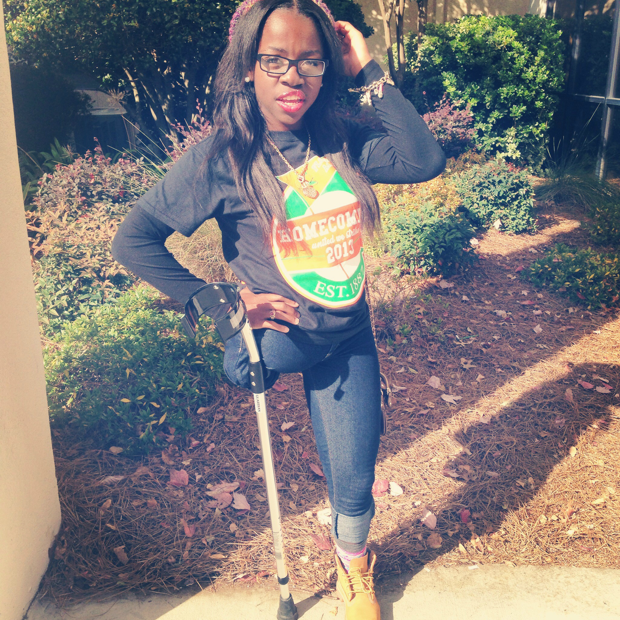 The Girl With One Leg- My journey in accepting my disability