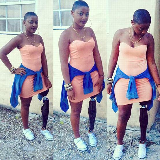 Don't let your disability limit or discourage you