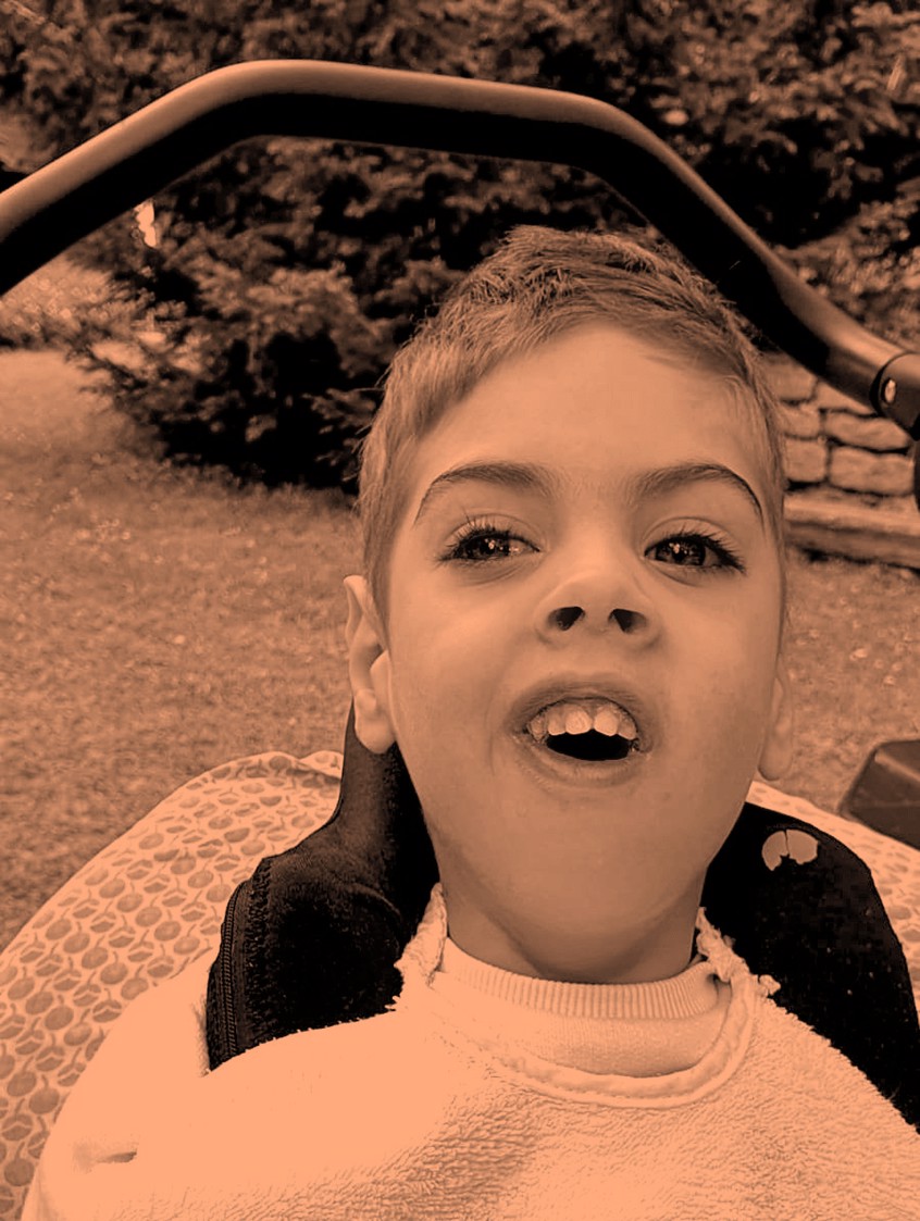 Edo's daily fight for (a full and happy) life!!