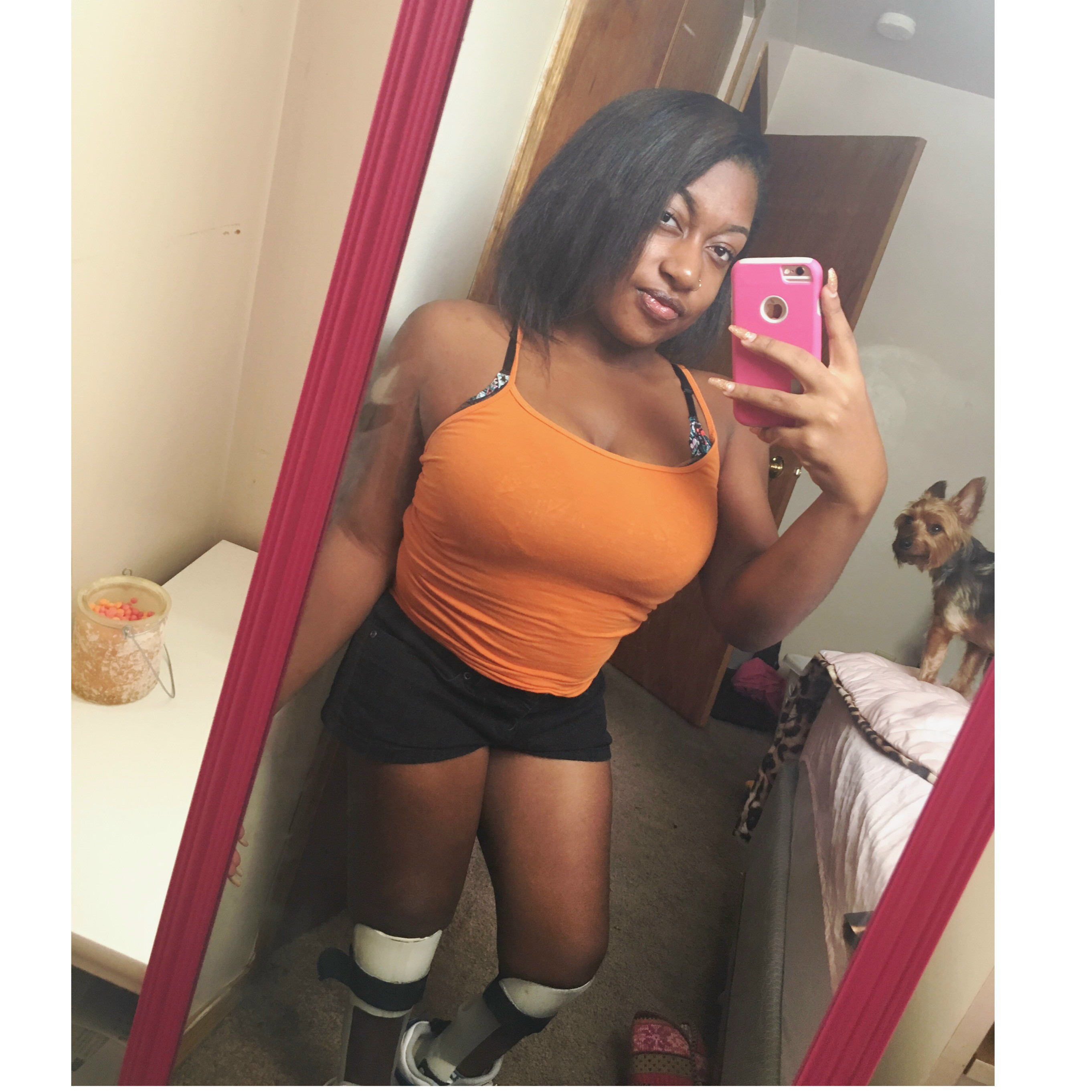 My Spina Bifida Journey