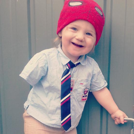 How to Parent A Kid With Limb Difference: Malakye the Magnifient