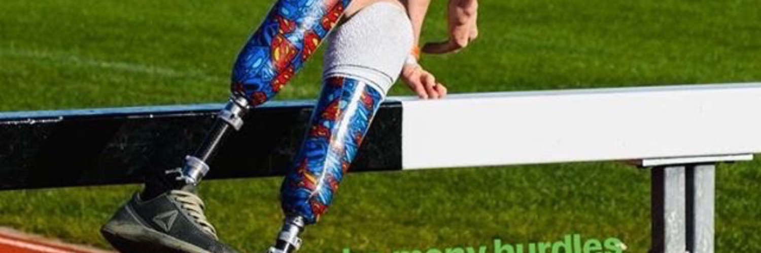 Never Stop Achieving with Congenital Limb Differences