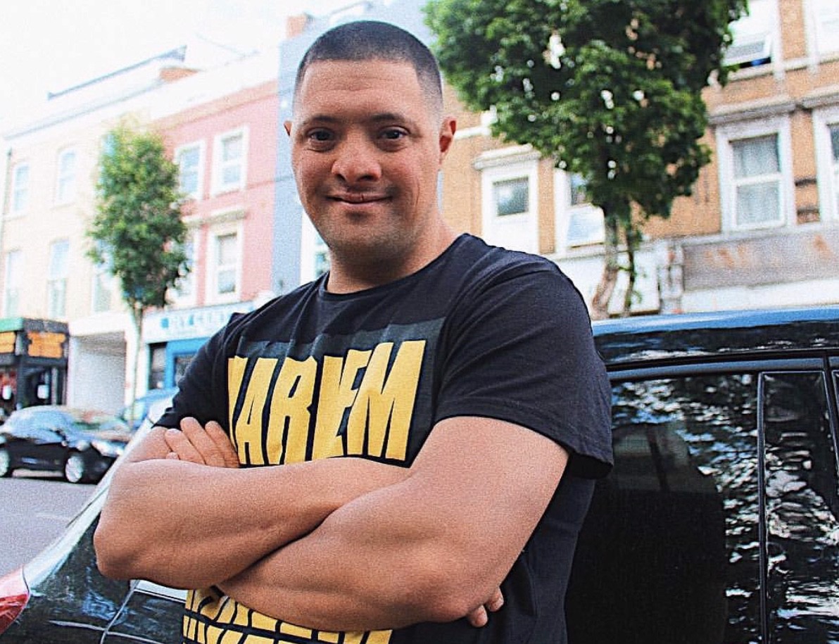 Down syndrome doesn’t make you different