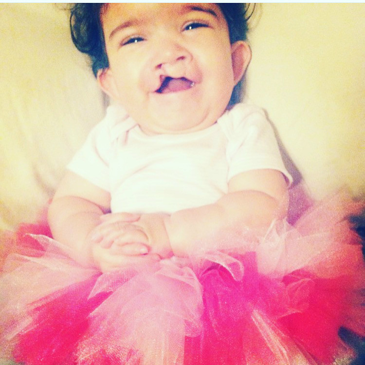 Cupcake defying the odds: Life with Spina Bifida