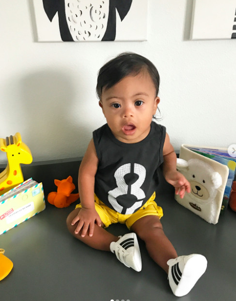 Our Down syndrome Story, Our Diagnosis, Our Son