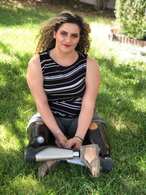 An Amputee in Higher Education