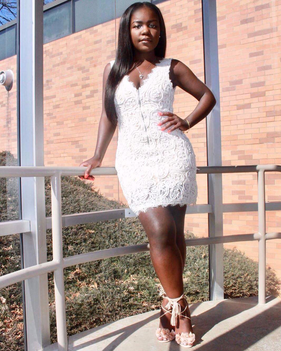 Dance is Living: How Scleroderma Has Taught Me to Live
