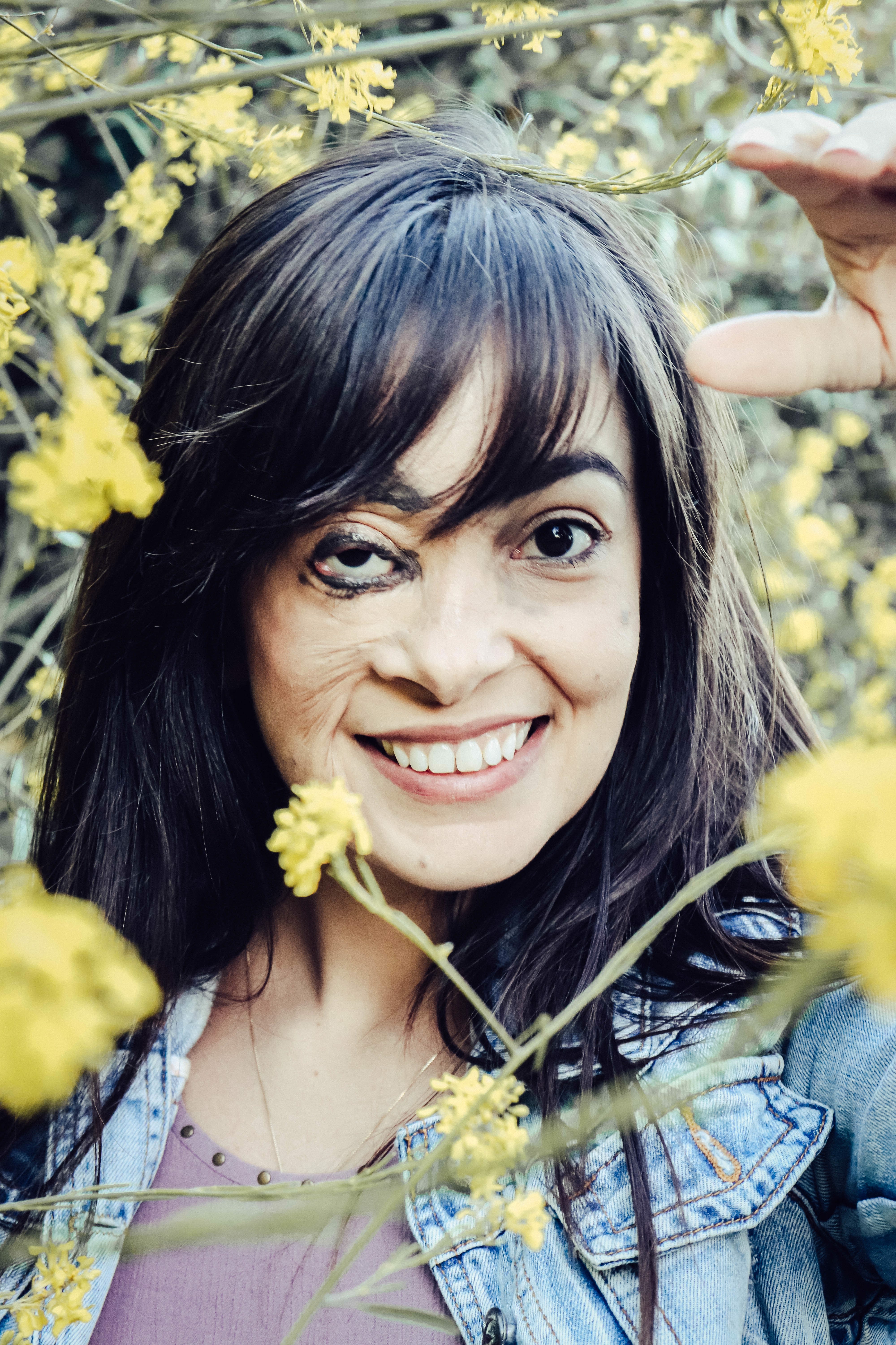 What happened to my face: Loving my dots with Nevus