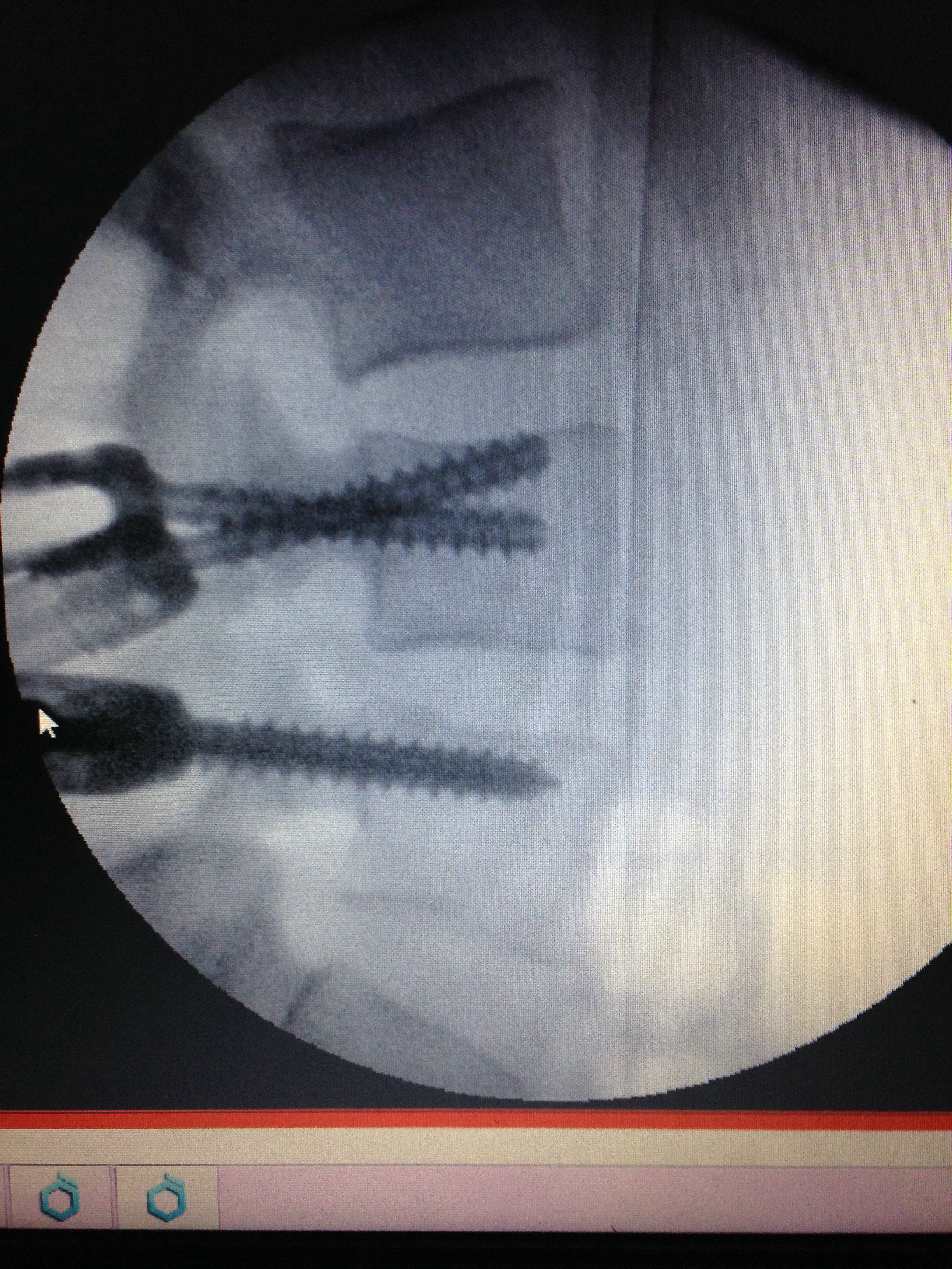 Fighting through my medical journey