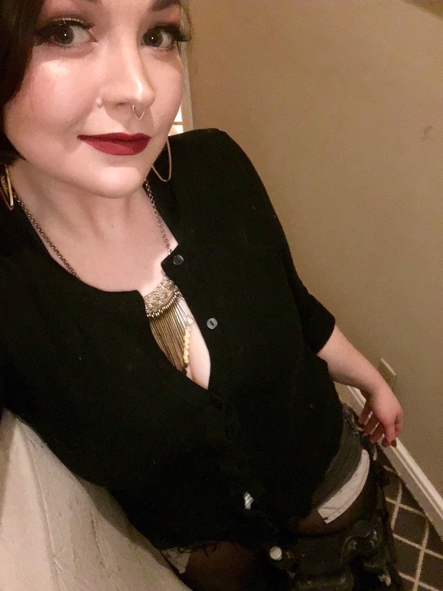 Burning to Live with Complex Regional Pain Syndrome