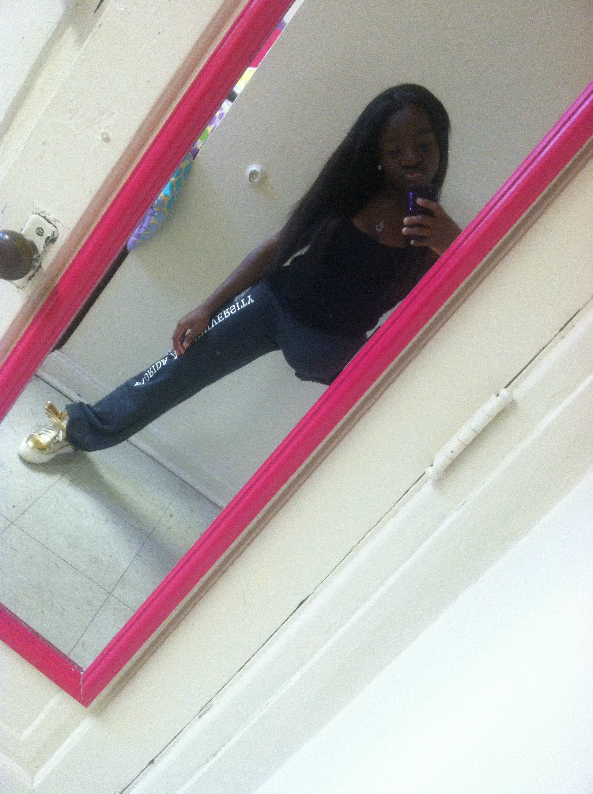 The Girl With One Leg- My journey in accepting my disability