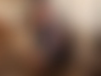 Beauty Behind The Bandages with Epidermolysis Bullosa