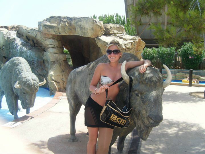 My Beef and Chicken Legs: Life with Congenital Lymphoedema