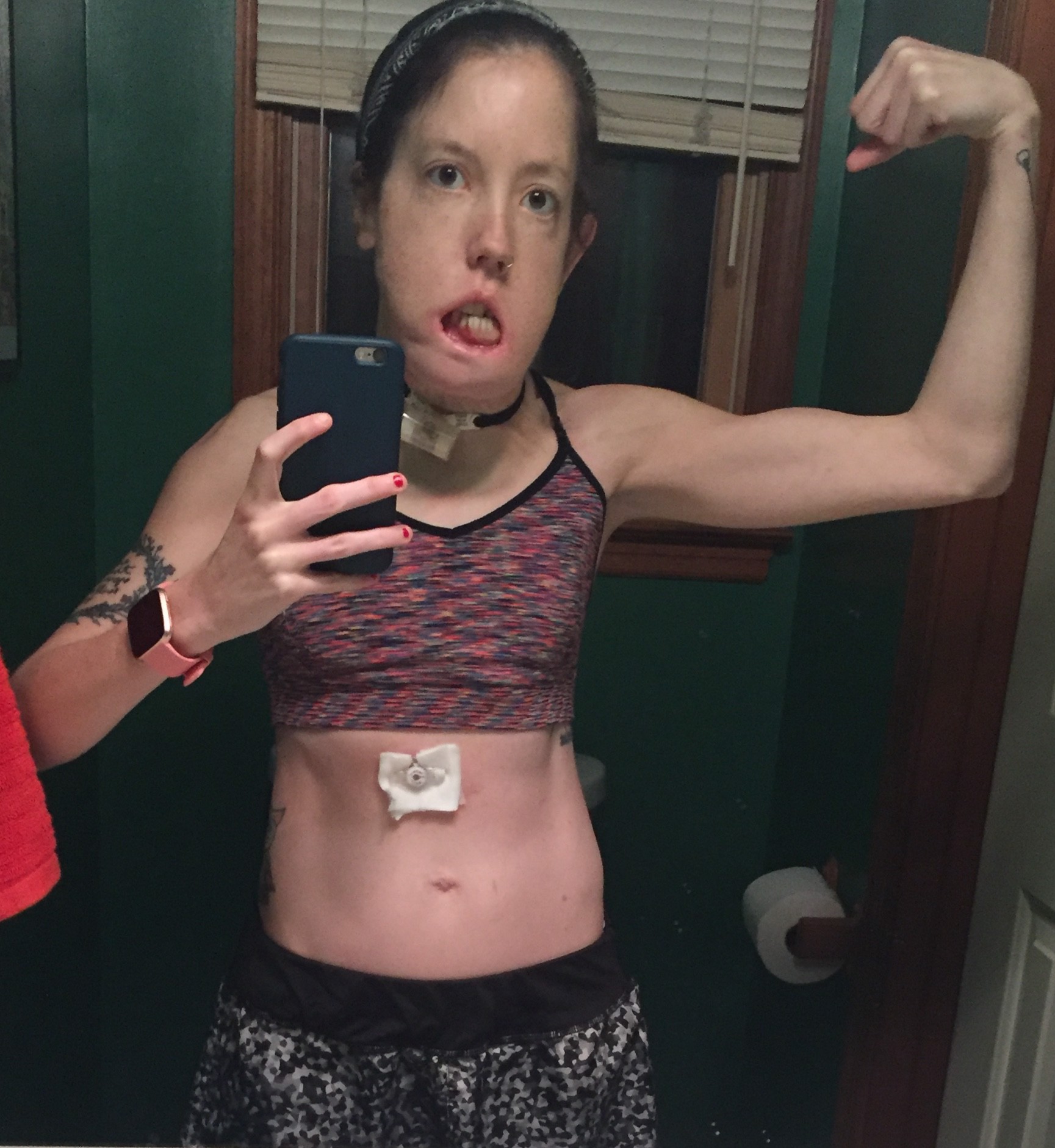 Feeding Tube Fitness