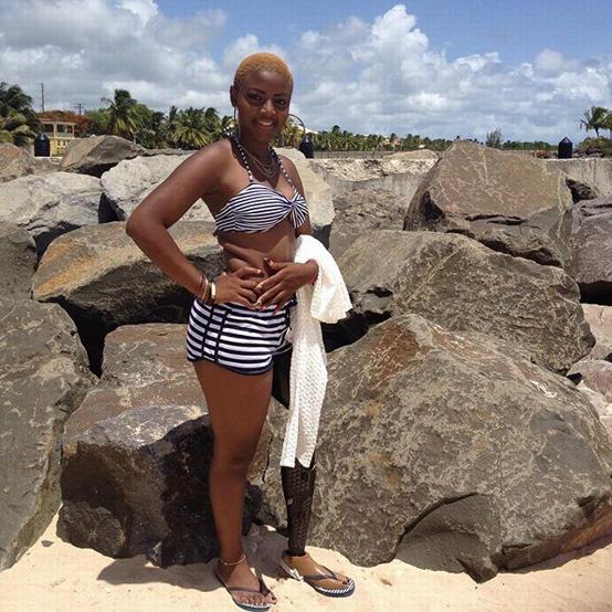 Don't let your disability limit or discourage you