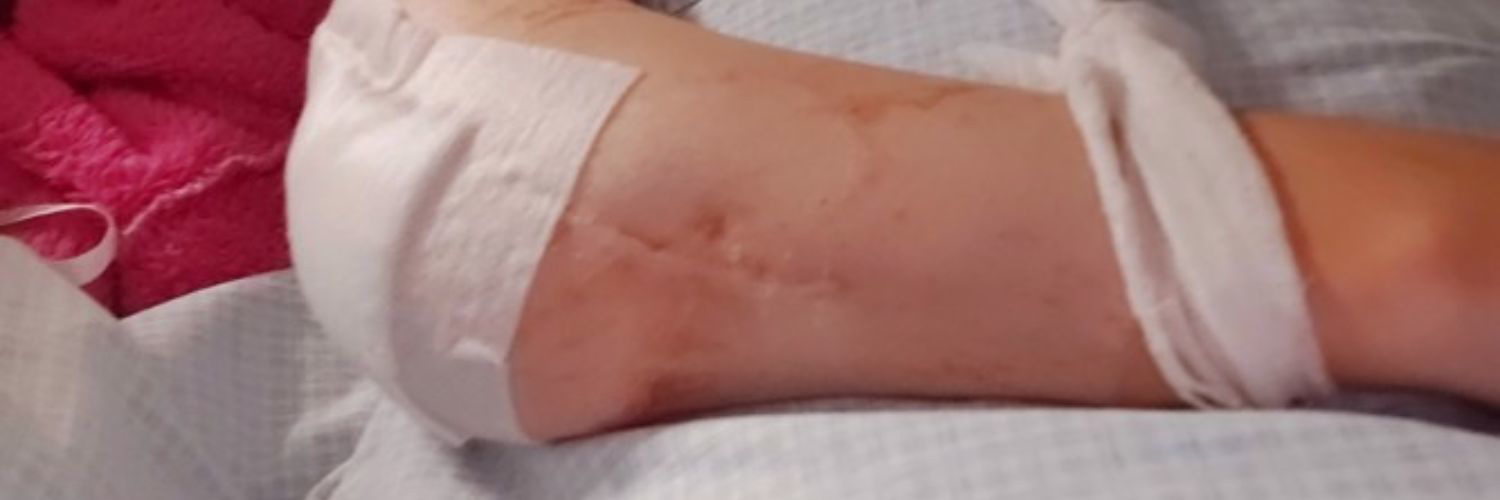 How trust saved my life