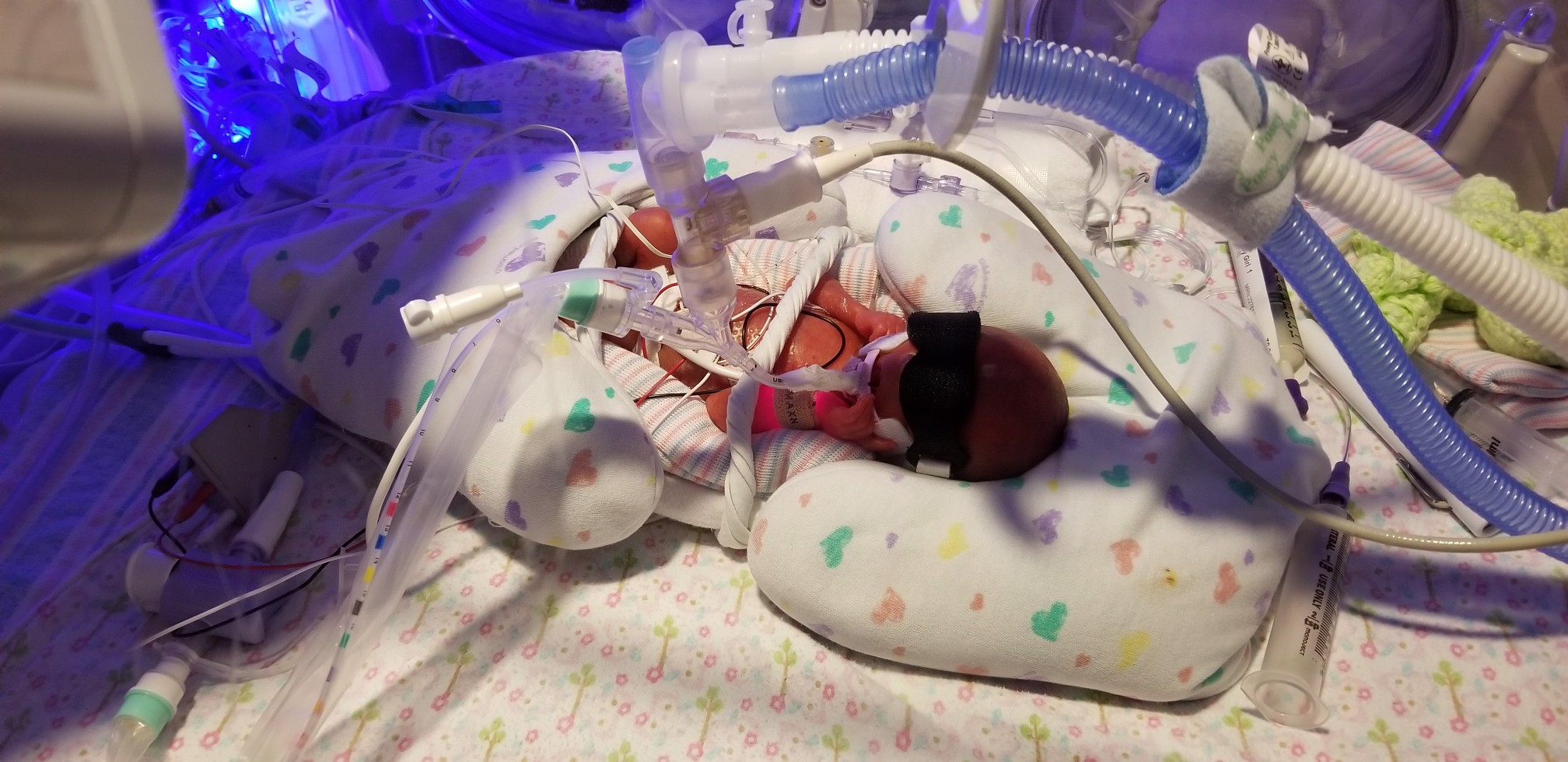 Lily’s Little Lungs