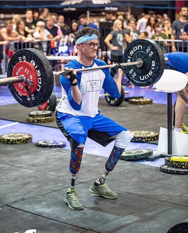 Never Stop Achieving with Congenital Limb Differences