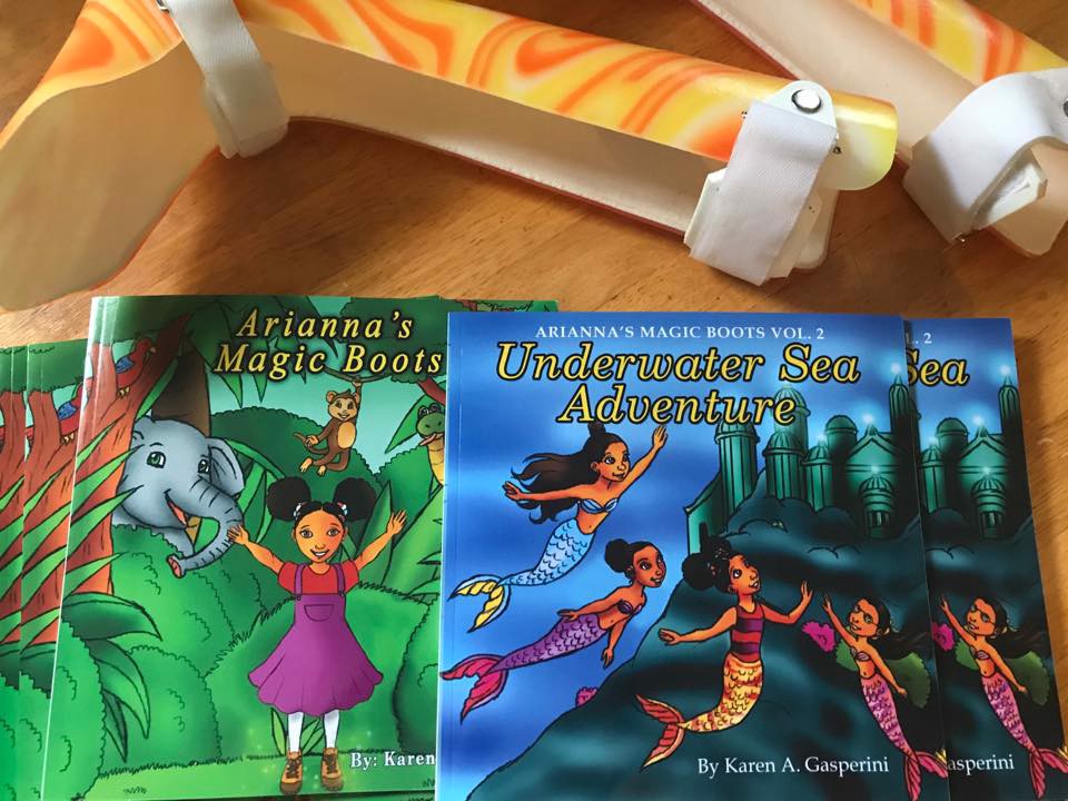 Living with Beals syndrome