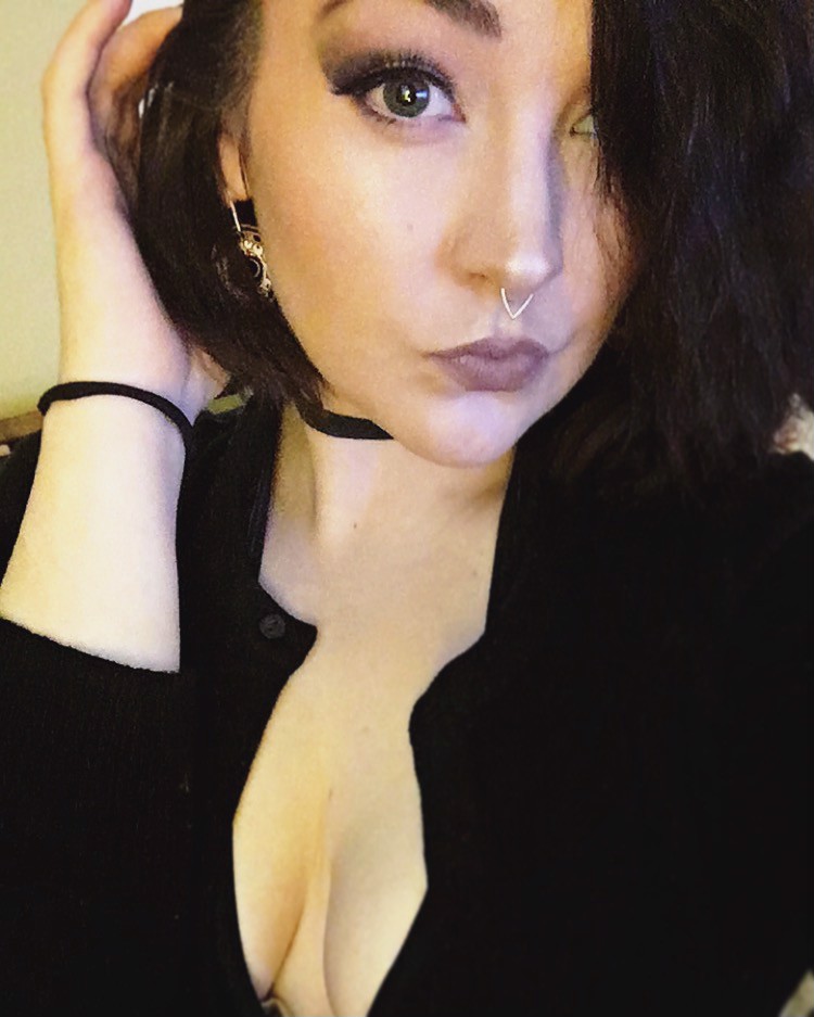 Burning to Live with Complex Regional Pain Syndrome