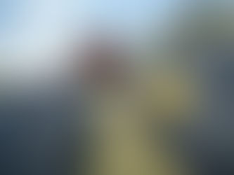 Learning how to live again after limb loss