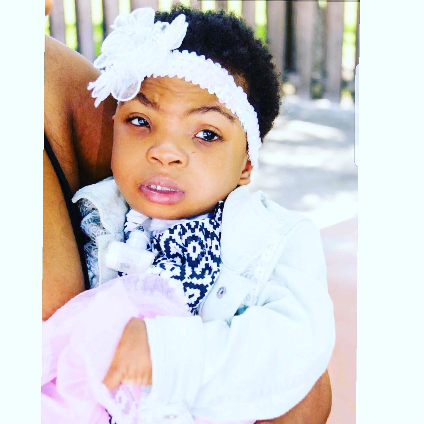 Overcoming All Obstacles with Cri du chat syndrome