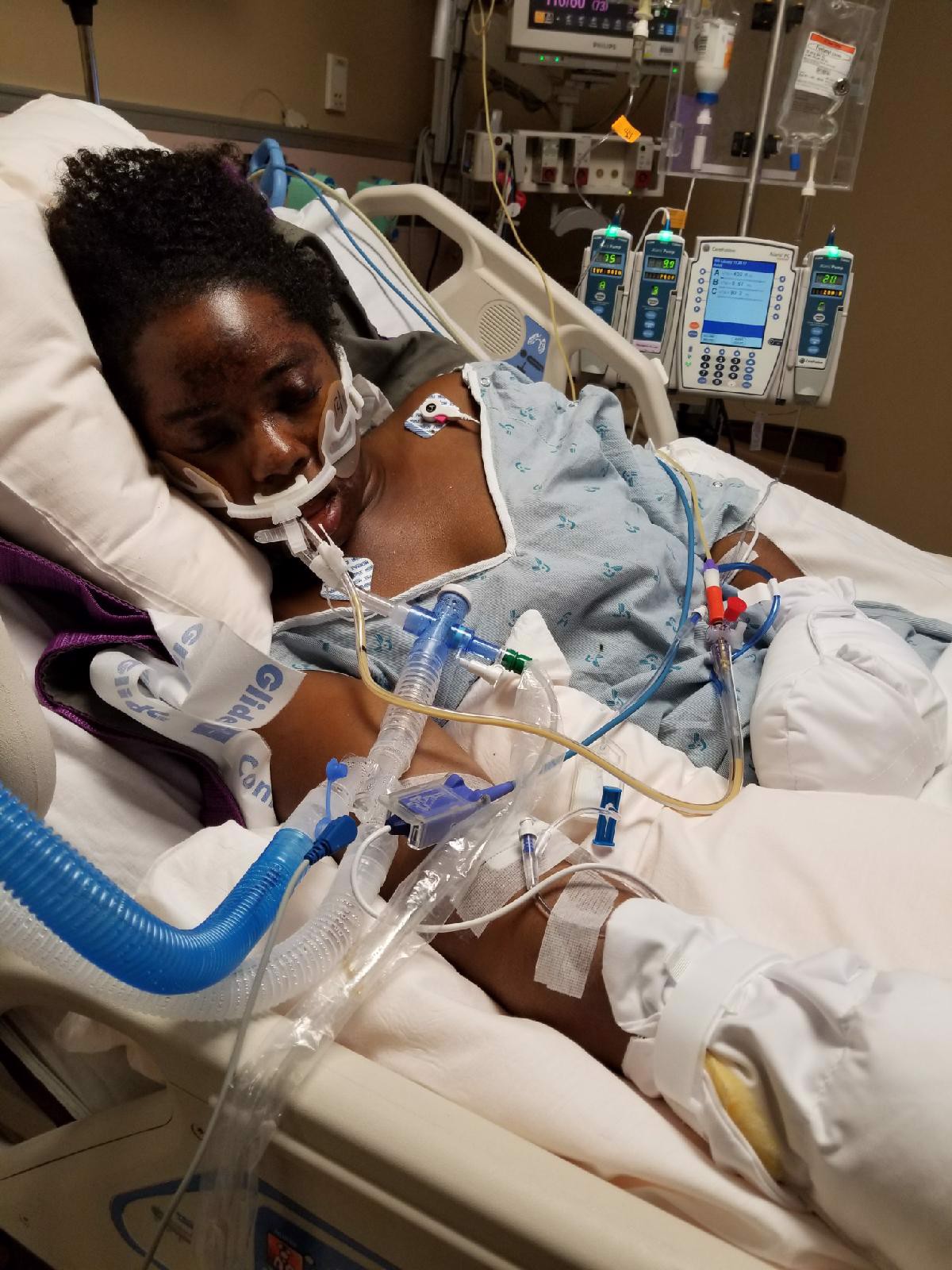 Miracle Child: How I survived a tragic accident