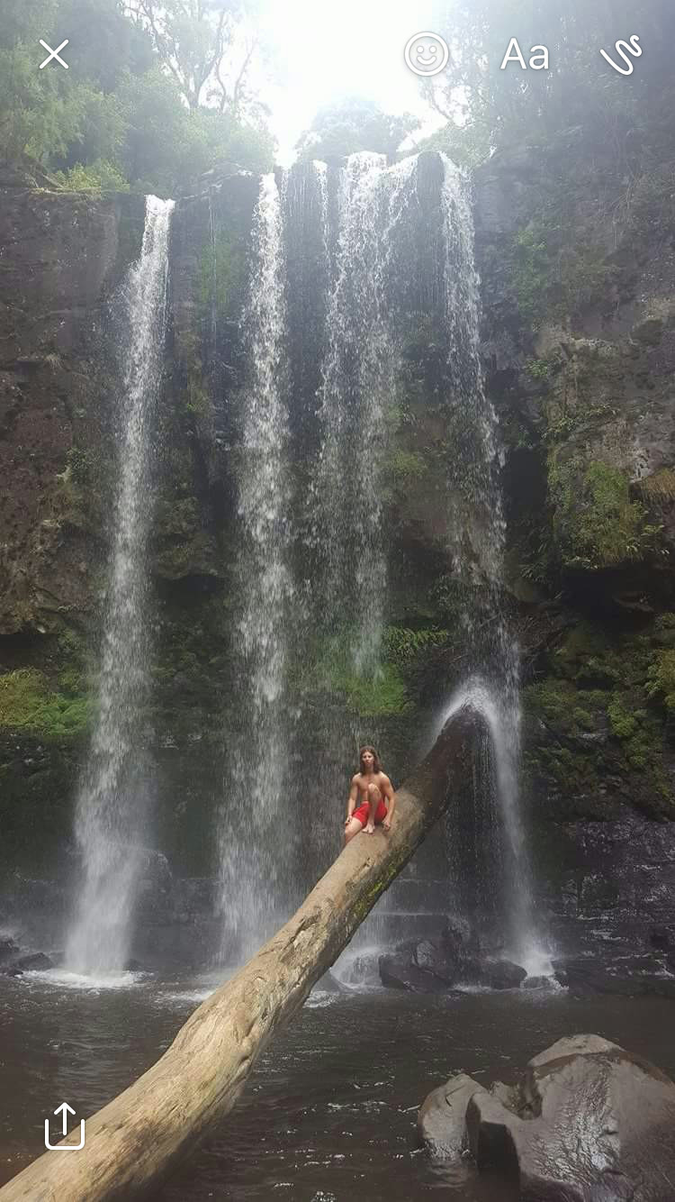 Controlling My Narrative & Owning It With Congenital Differences