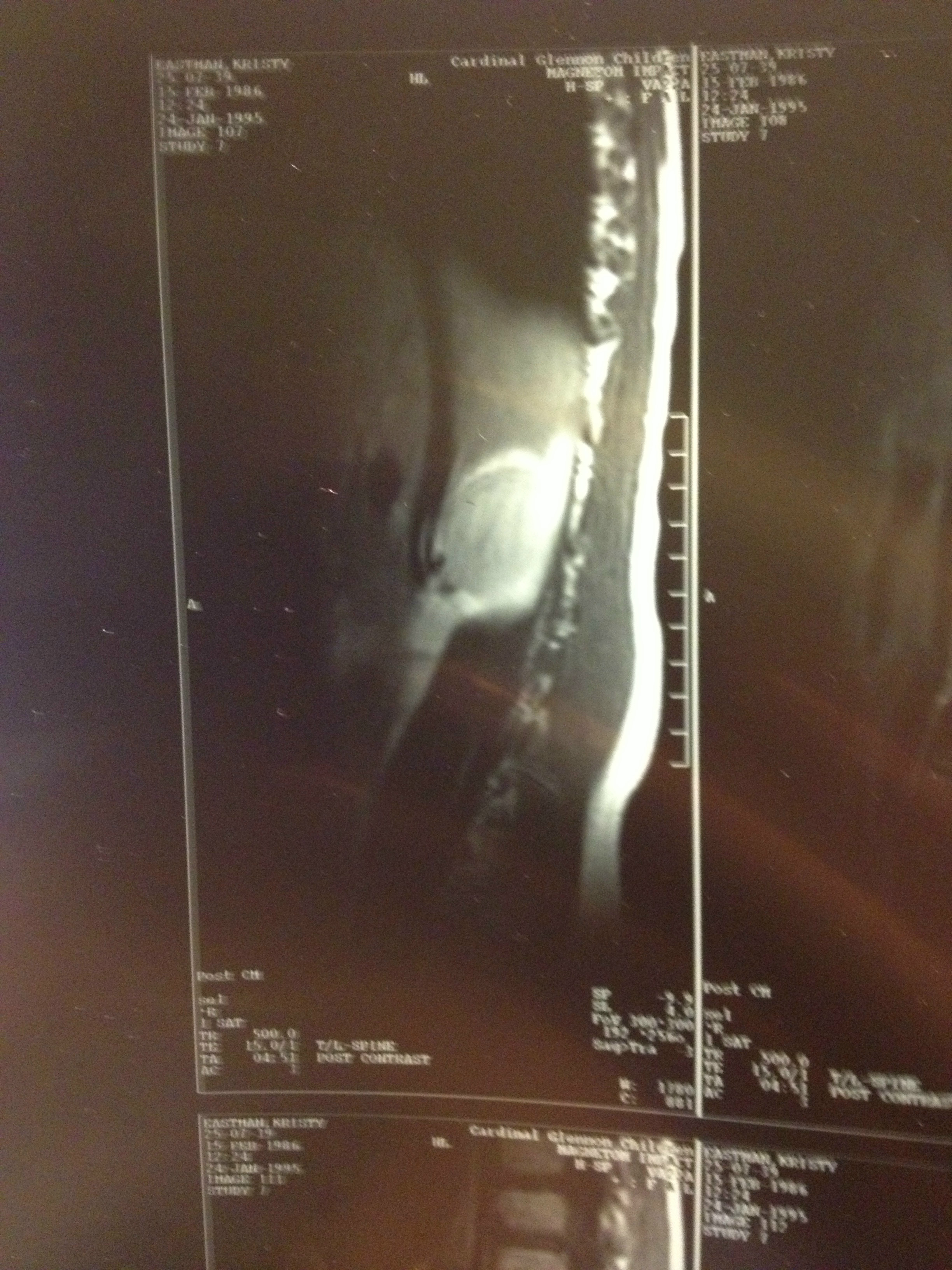 Kristy Wimberly: Ability Is Stronger Than Any Disability