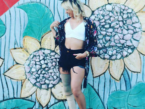 Vida DEFICIENTE: Living my life with a Prosthetic