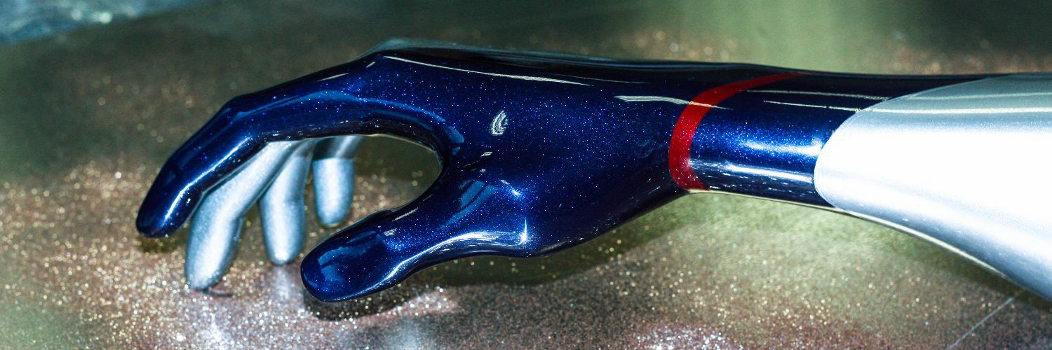 Glaze yourself- New chapter of arm prosthesis history