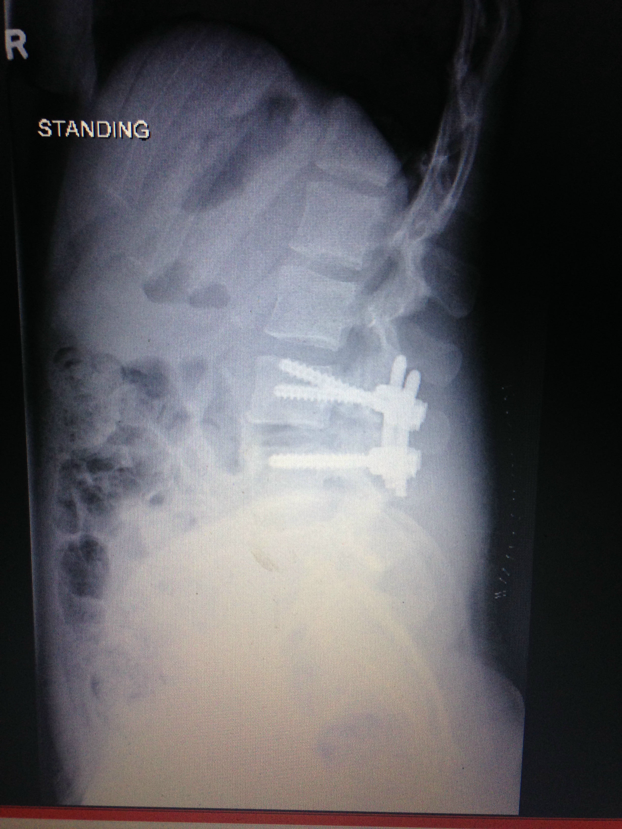 Fighting through my medical journey