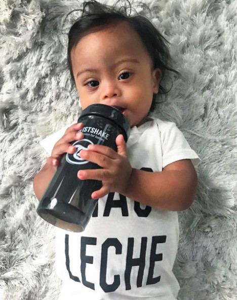 Our Down syndrome Story, Our Diagnosis, Our Son