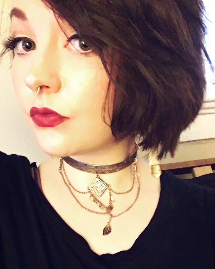 Burning to Live with Complex Regional Pain Syndrome