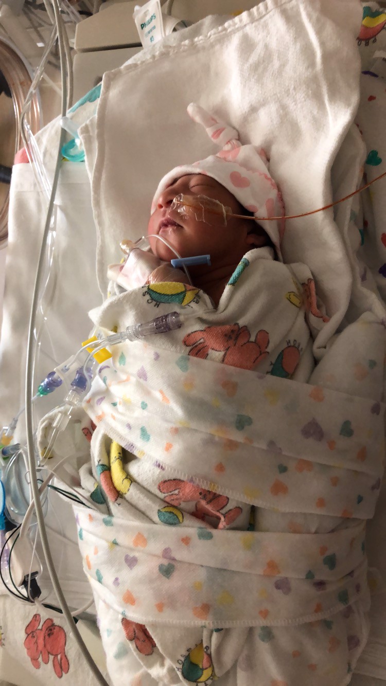 Hennessy  (microcephaly warrior) đ