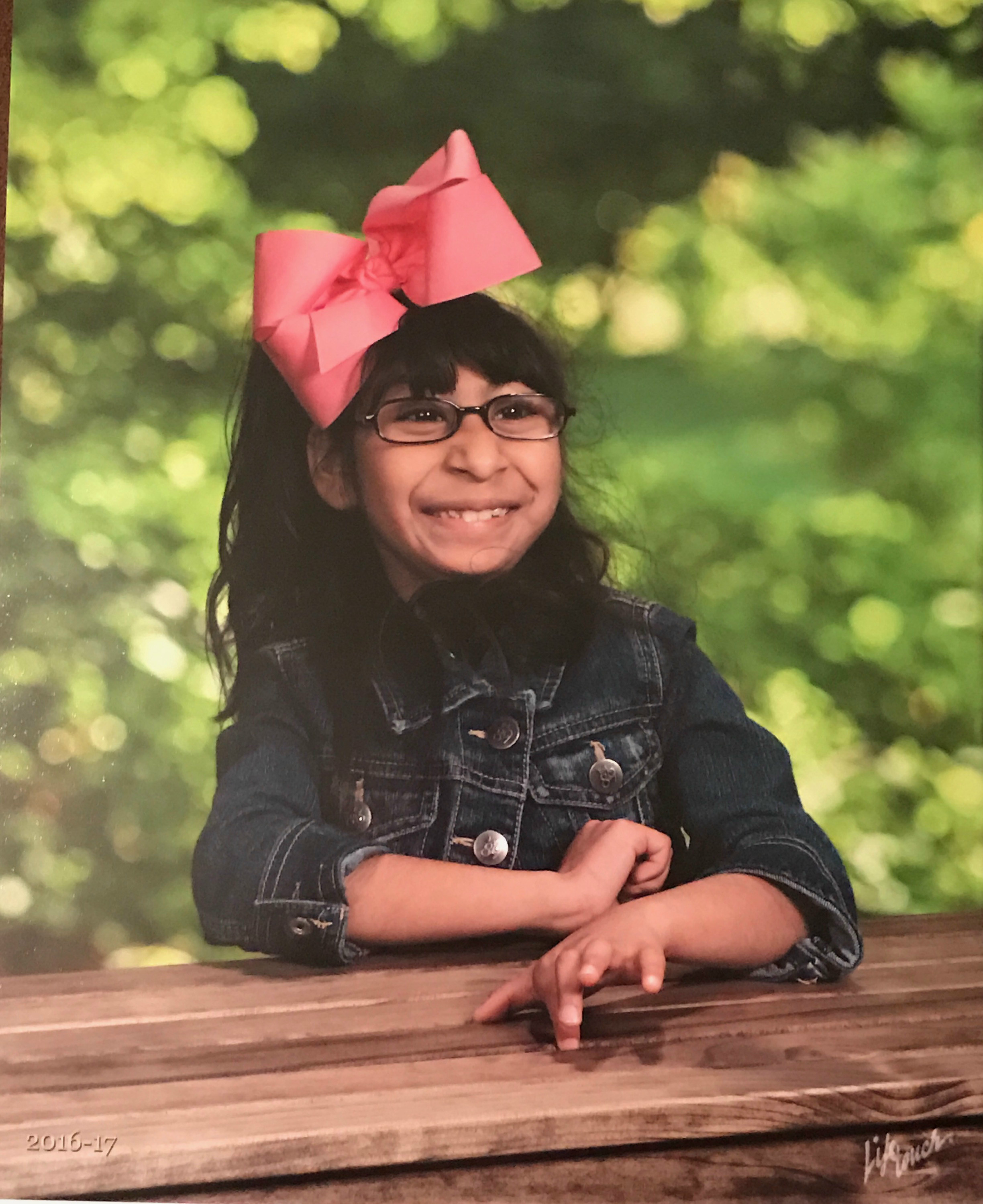 Our Miracle Child Living with Microcephaly