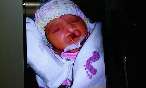 Aerilyn's Life with Trisomy13
