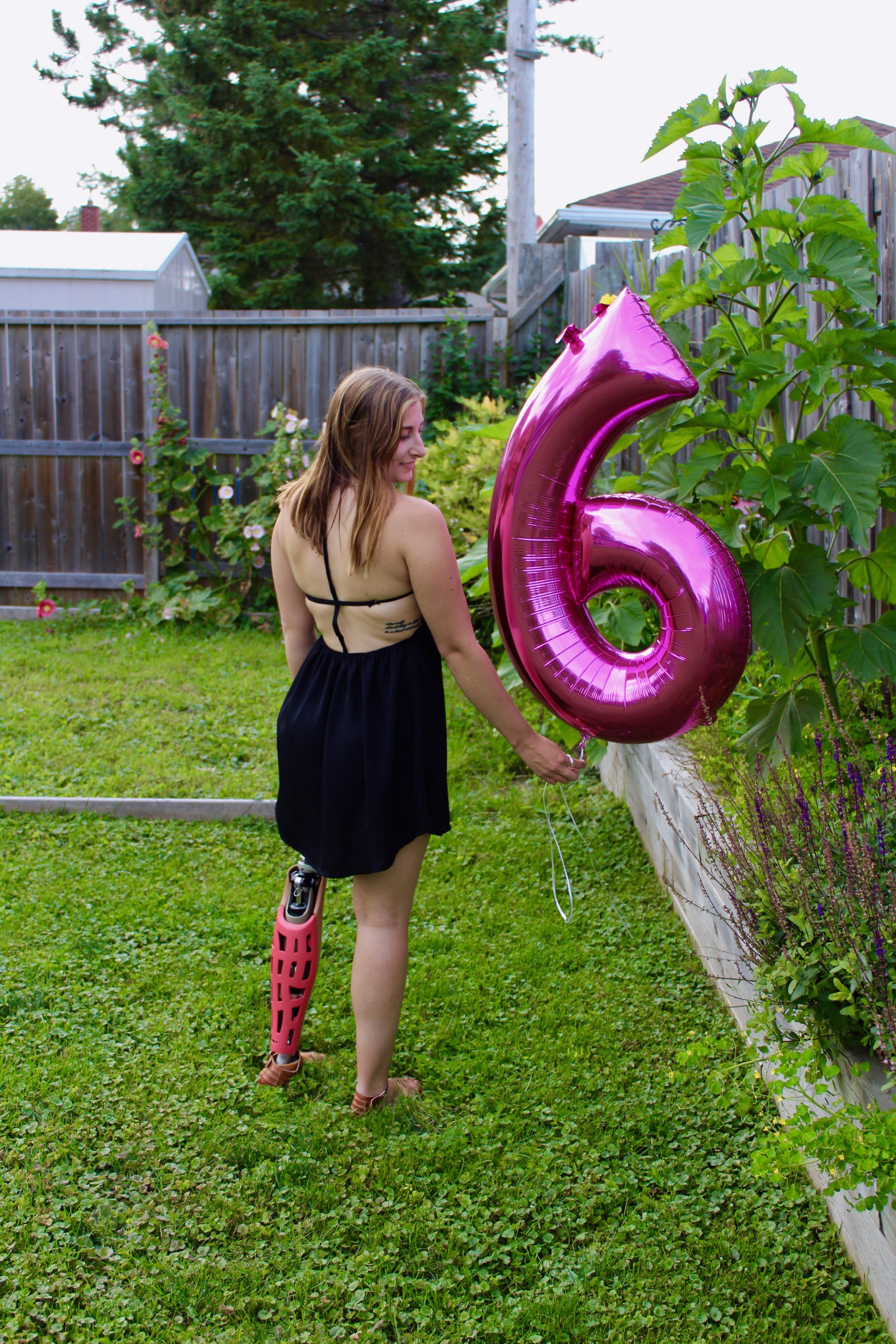 10 Tips for Coping with Becoming an Amputee