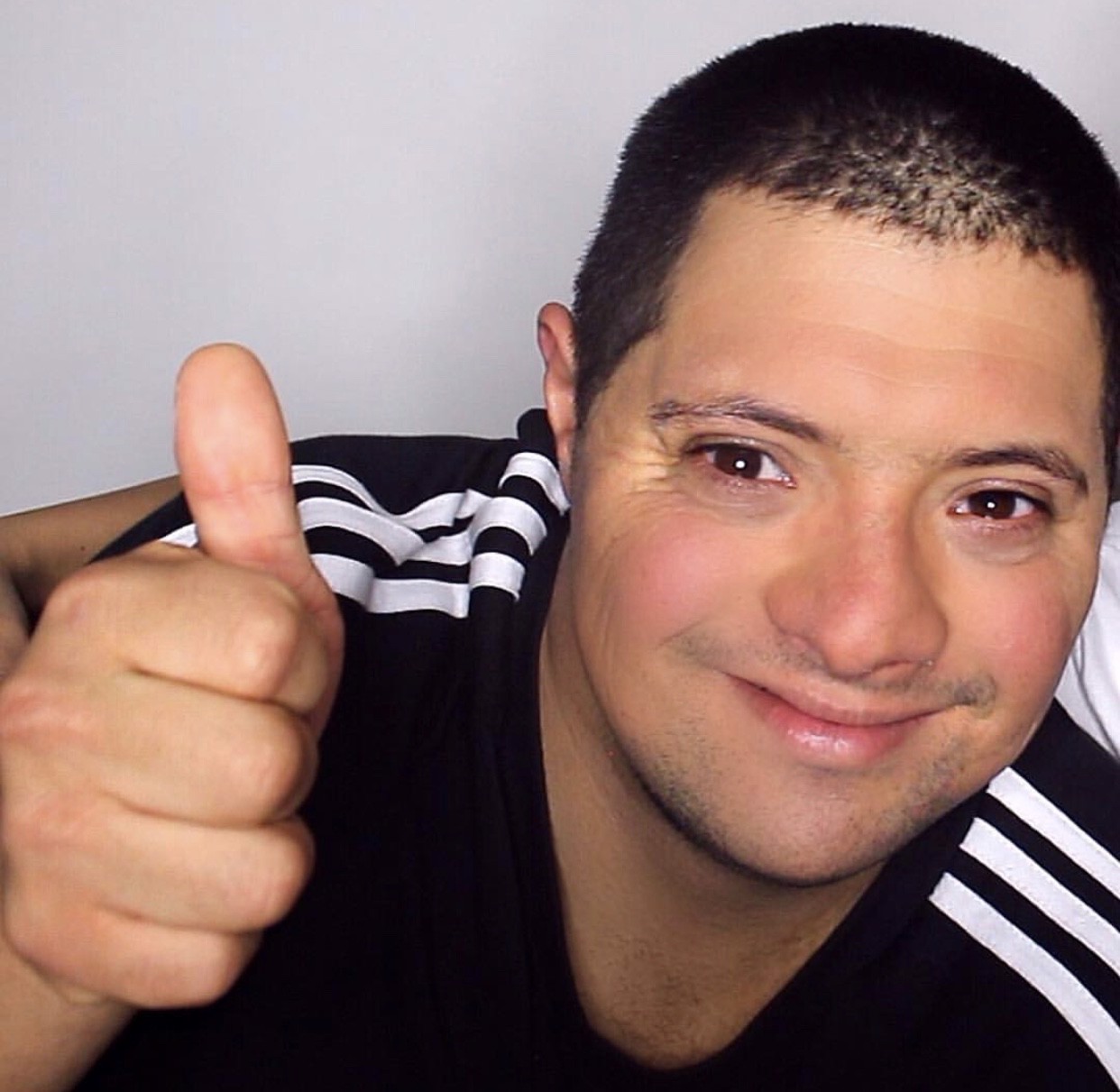 Down syndrome doesn’t make you different