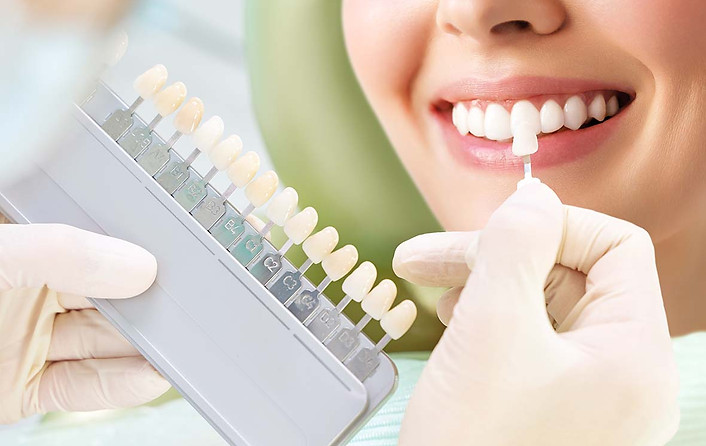 teeth whitening.jpg