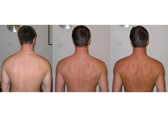 melanotan results pictures B L O G melanotan results pictures B L O G