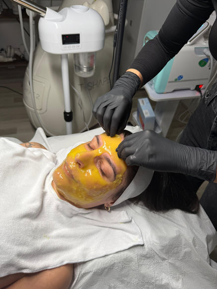 Practitioner applying a bright yellow facial peel mask