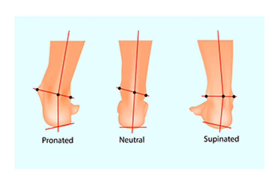 Image sourced from footdoctorokc.com