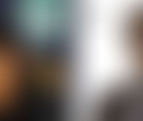 Célébrités: ils ont franchi le pas de la greffe de cheveux, le saviez-vous?