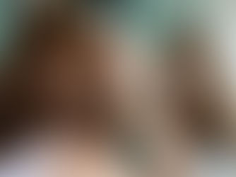 La greffe de cheveux chez les femmes