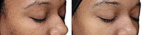 0501-Jessica_Original_VIPEEL.jpg